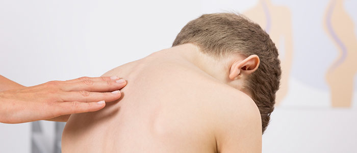 Chiropractic Care in St Paul MN For Scoliosis Relief